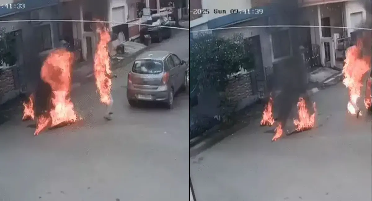 उज्जैन में फर्नीचर कारोबारी ने खुद को लगाई आग, इलाज के दौरान मौत; पारिवारिक विवाद बना वजह